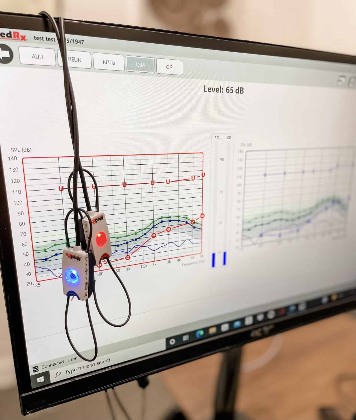 Real Ear Measurements (REM)