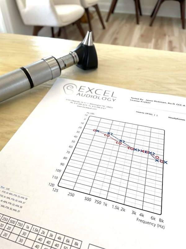 audiological test results showing frequencies heard